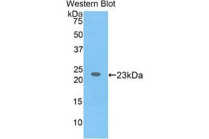 Western Blotting (WB) image for anti-Interleukin 17 Receptor B (IL17RB) (AA 310-499) antibody (ABIN1859361)