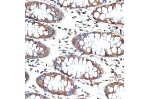 Immunohistochemistry of paraffin-embedded human colon using MUC4 Rabbit mAb (ABIN7268692) at dilution of 1:100 (40x lens). (MUC4 antibody)
