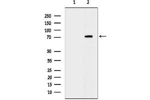 anti-Protein Kinase, CGMP-Dependent, Type II (PRKG2) (N-Term) antibody