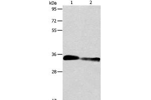 Western Blot analysis of Mouse kidney and Rat kidney tissue using ACY3 Polyclonal Antibody at dilution of 1:750