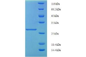 SDS-PAGE (SDS) image for Inhibin, beta A (INHBA) (AA 311-426) protein (His-SUMO Tag) (ABIN5709761) (INHBA Protein (AA 311-426) (His-SUMO Tag))