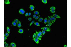 Immunofluorescent analysis of PC-3 cells using ABIN7153725 at dilution of 1:100 and Alexa Fluor 488-congugated AffiniPure Goat Anti-Rabbit IgG(H+L) (GFRA3 antibody  (AA 32-236))