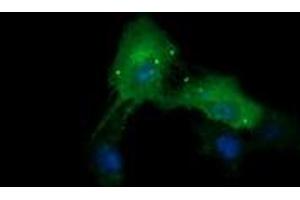 Image no. 3 for anti-Cancer/testis Antigen 1B (CTAG1B) antibody (ABIN1499890) (CTAG1B antibody)