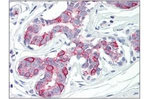 Human Breast: Formalin-Fixed, Paraffin-Embedded (FFPE) (PKMYT1 antibody  (Internal Region))