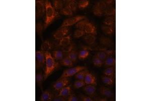 Immunofluorescence analysis of U-2 OS cells using HEBP2 antibody (ABIN7267604) at dilution of 1:100. (HEBP2 antibody  (AA 1-205))