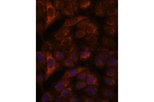 Immunofluorescence analysis of U-2 OS cells using HEBP2 antibody (ABIN7267604) at dilution of 1:100. (HEBP2 antibody  (AA 1-205))