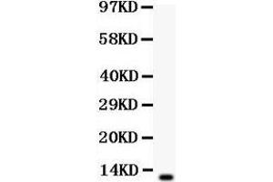 Anti-beta Defensin 1 antibody,Western blotting All lanes: Anti Defensin 1  at 0. (beta Defensin 1 antibody  (C-Term))