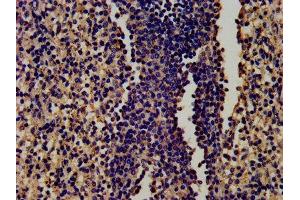 IHC image of ABIN7134517 diluted at 1:450 and staining in paraffin-embedded human spleen tissue performed on a Leica BondTM system. (Lactoferrin antibody)