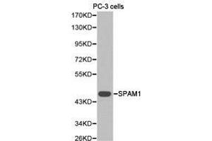 Western Blotting (WB) image for anti-Sperm Adhesion Molecule 1 (PH-20 Hyaluronidase, Zona Pellucida Binding) (SPAM1) antibody (ABIN1874917) (SPAM1 antibody)