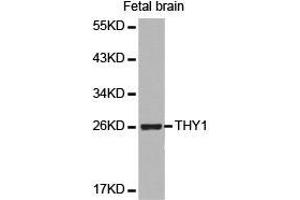 Western Blotting (WB) image for anti-CD90 (THY1) antibody (ABIN1875094) (CD90 antibody)