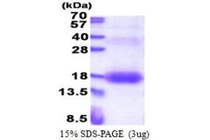 SDS-PAGE (SDS) image for Zinc Ribbon Domain Containing 1 (ZNRD1) (AA 1-126) protein (His tag) (ABIN5853336)