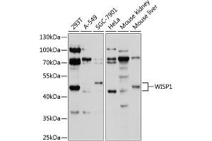 Western blot analysis of extracts of various cell lines, using WISP1 antibody (ABIN1683290, ABIN3017735, ABIN3017736 and ABIN6220223) at 1:1000 dilution. (WISP1 antibody  (AA 158-367))