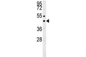 SUV39H1 western blot analysis in MDA-MB435 lysate. (SUV39H1 antibody  (N-Term))