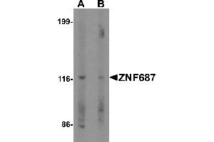 Western blot analysis of ZNF687 in Jurkat cell lysate with ZNF687 antibody at 0. (ZNF687 antibody  (C-Term))