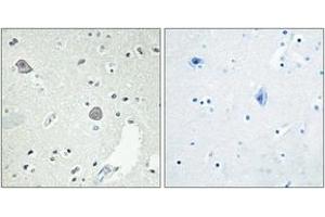 Immunohistochemistry analysis of paraffin-embedded human brain tissue, using DRD1 Antibody. (Dopamine Receptor d1 antibody  (AA 135-184))