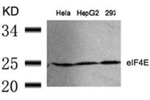 Image no. 3 for anti-Eukaryotic Translation Initiation Factor 4E (EIF4E) (Ser209) antibody (ABIN197472) (EIF4E antibody  (Ser209))