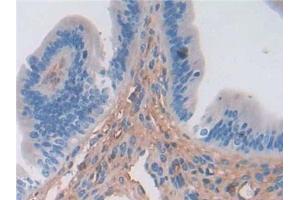 Detection of a1ACT in Mouse Uterus Tissue using Polyclonal Antibody to Alpha-1-Antichymotrypsin (a1ACT) (SERPINA3 antibody  (AA 23-253))