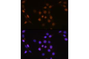 Immunofluorescence (IF) image for anti-Cell Division Cycle 25 Homolog A (S. Pombe) (CDC25A) (AA 235-484) antibody (ABIN3021626)