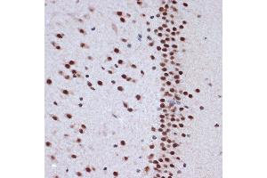 Immunohistochemistry of paraffin-embedded rat brain using A Rabbit mAb (ABIN7265387) at dilution of 1:100 (40x lens). (BAF53A antibody)
