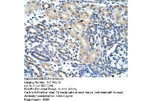 Rabbit Anti-WBSCR1 Antibody  Paraffin Embedded Tissue: Human Kidney Cellular Data: Epithelial cells of renal tubule Antibody Concentration: 4. (EIF4H antibody  (Middle Region))