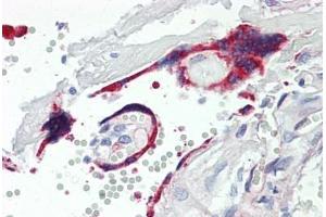 Human Placenta: Formalin-Fixed, Paraffin-Embedded (FFPE) (VASH1 antibody  (AA 3-101))
