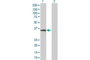 Western Blot analysis of ZBTB32 expression in transfected 293T cell line by ZBTB32 MaxPab polyclonal antibody.
