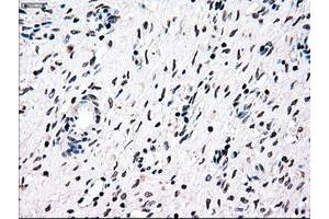 Image no. 1 for anti-Nuclear Receptor Binding Protein 1 (NRBP1) antibody (ABIN1499822) (NRBP1 antibody)