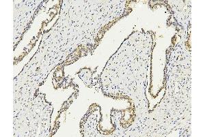 IHC analysis of PARN using anti PARN antibody (ABIN6719422). (PARN antibody  (AA 1-301))