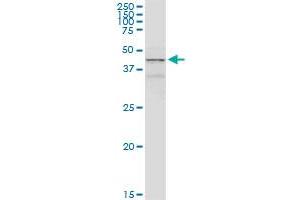 ACADM MaxPab rabbit polyclonal antibody. (Medium-Chain Specific Acyl-CoA Dehydrogenase, Mitochondrial (AA 1-421) antibody)