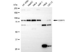 anti-Structure Specific Recognition Protein 1 (SSRP1) antibody