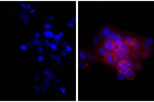 Human epithelial carcinoma cell line HEp-2 was stained with Mouse Anti-Human CD44-UNLB and DAPI. (Goat anti-Mouse Ig (Heavy & Light Chain) Antibody (beta-Gal))