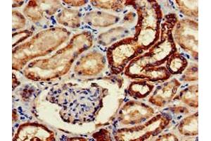 Immunohistochemistry of paraffin-embedded human kidney tissue using ABIN7161126 at dilution of 1:100 (WWP2 antibody  (AA 145-367))