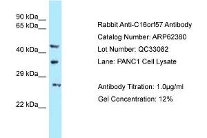 Western Blotting (WB) image for anti-U6 SnRNA Biogenesis 1 (USB1) (C-Term) antibody (ABIN2789122) (C16orf57 antibody  (C-Term))