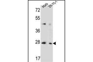 T4S4 Antibody (N-term) (ABIN653705 and ABIN2843022) western blot analysis in A549,ZR-75-1 cell line lysates (35 μg/lane). (TM4SF4 antibody  (N-Term))
