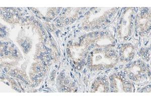 ABIN6276867 at 1/100 staining Human prostate tissue by IHC-P. (FTL antibody  (C-Term))