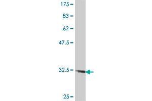 Western Blot detection against Immunogen (34. (SLC6A4 antibody  (AA 181-252))