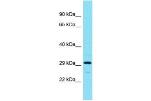 Host: Rabbit Target Name: ADPRHL1 Sample Type: RPMI-8226 Whole Cell lysates Antibody Dilution: 1. (ADPRHL1 antibody  (Middle Region))