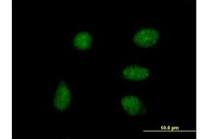 Immunofluorescence of purified MaxPab antibody to DPPA4 on HeLa cell.