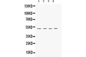 Anti- Keratocan Picoband antibody, Western blottingAll lanes: Anti Keratocan  at 0. (KERA antibody  (C-Term))