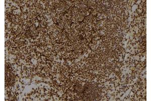 ABIN6276891 at 1/100 staining Rat spleen tissue by IHC-P. (Kallikrein 1 antibody  (Internal Region))