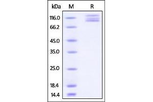 Human ITGAV & ITGB3 Heterodimer Protein on SDS-PAGE under reducing (R) condition. (CD51/CD61 Protein (AA 31-992) (His tag))