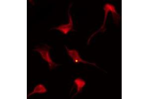 ABIN6269218 staining A2780 by IF/ICC. (AKT2 antibody  (C-Term))