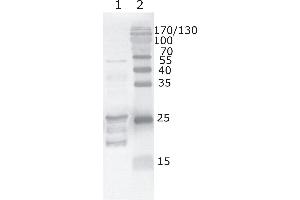 Western Blot testing of HIV-1 recombinant Tat protein. (HIV-1 Tat antibody  (AA 59-67))