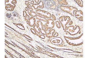 ABIN190842 (6µg/ml) staining of paraffin embedded Human Prostate. (Kallikrein 2 antibody  (Internal Region))
