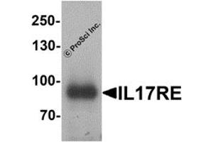 Western Blotting (WB) image for anti-Interleukin 17 Receptor E (IL17RE) antibody (ABIN1077424) (IL17RE antibody)