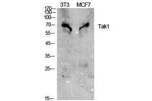 Western Blotting (WB) image for anti-Nuclear Receptor Subfamily 2, Group C, Member 2 (NR2C2) (Tyr142) antibody (ABIN3187165) (TR4 antibody  (Tyr142))