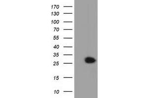 HEK293T cells were transfected with the pCMV6-ENTRY control (Left lane) or pCMV6-ENTRY GSTT2 (Right lane) cDNA for 48 hrs and lysed. (GSTT2 antibody)