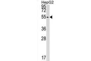 Western Blotting (WB) image for anti-Cleavage and Polyadenylation Factor I Subunit 1 (CLP1) antibody (ABIN2999240)