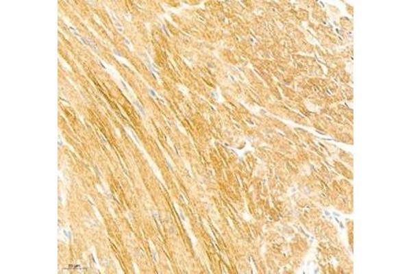 Collagen Type V antibody