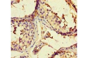 Immunohistochemistry of paraffin-embedded human testis tissue using ABIN7167960 at dilution of 1:100 (ARHGAP42 antibody  (AA 541-728))